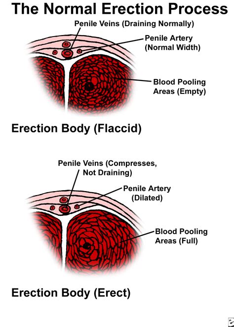 accidental boner|Penis: Anatomy, Picture, Erection, and Ejaculation